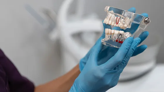 Modelo dental profissional demonstrando estrutura dos dentes